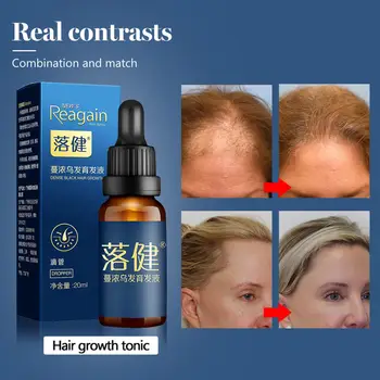 Rast vlasov Podstate Olej Proti vypadávaniu Vlasov Produkty pre Rast Vlasov Liečba Genger Prírodné Sérum na Vlasy Thickener Starostlivosti Riešenia