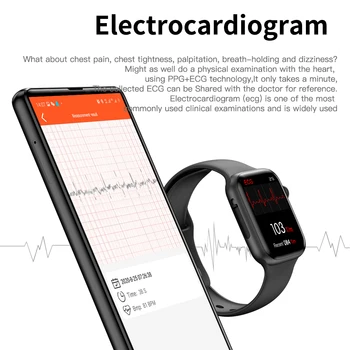 Pôvodné Smart Hodinky w34+ Smartwatch Môžete Prijať Hovor Whatsapp Oznámenie EKG Monitor Srdcovej frekvencie Anti-stratil Spôsobilosť Tracker