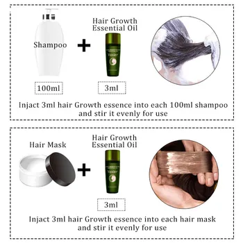 Zázvor Rast Vlasov Podstate Olej Účinný Extrakt Proti Vyživujú Vlasové Korienky Liečba, Prevencia Vypadávania Vlasov Starostlivosť O Vlasy Produkty