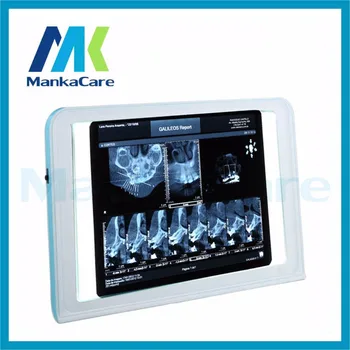 Zubná Klinika X-Ray Film Iluminátor Light Box Xray Viewer Svetelný Panel Obrazovky Pre Stomatológiu Lab Dodávky zdravotníckych negatoscope