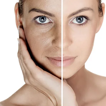 KONGDY Nový Príchod 30 Škvrny Tela Zubov Patch Glutatión Zosvetlenie Pokožky Skin Anti-Aging Redukovať Tmavé